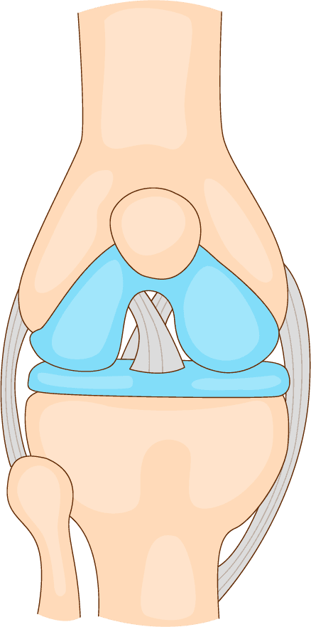 Illustration of a human knee joint showing cartilage, ligaments, and other structures for educational purposes.